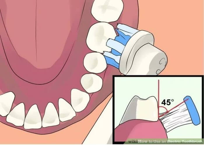 Як правильно використовувати електричну зубну щітку, - Переваги електричних зубних щіток
