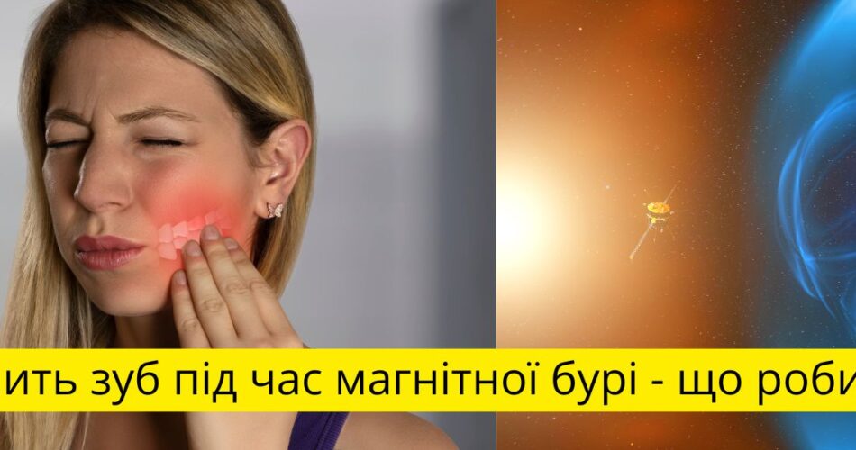 болить зуб під час магнітної бурі