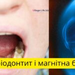 Періодонтит і магнітна буря
